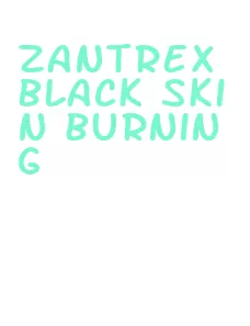 zantrex black skin burning