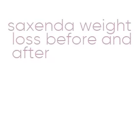 saxenda weight loss before and after