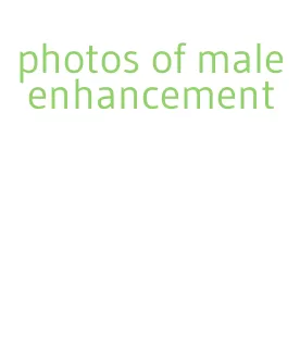 photos of male enhancement