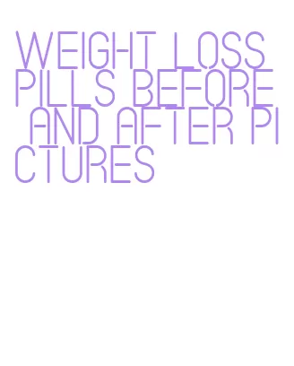 weight loss pills before and after pictures