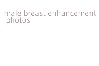 male breast enhancement photos