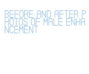 before and after photos of male enhancement