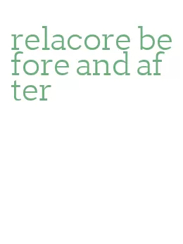 relacore before and after