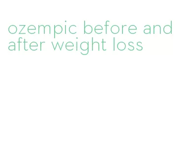 ozempic before and after weight loss