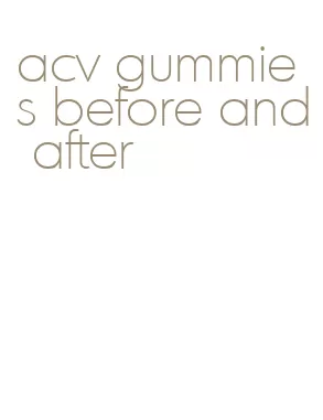 acv gummies before and after