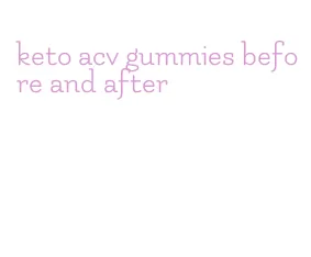 keto acv gummies before and after