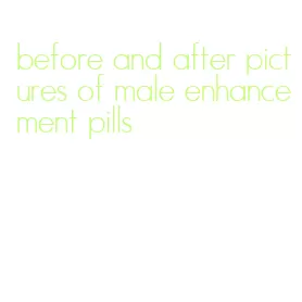 before and after pictures of male enhancement pills