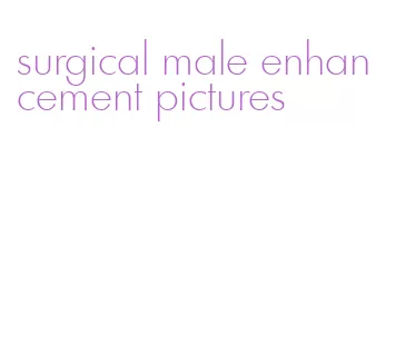 surgical male enhancement pictures