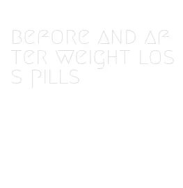 before and after weight loss pills