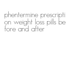 phentermine prescription weight loss pills before and after