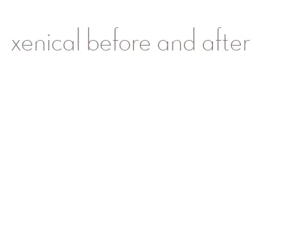 xenical before and after