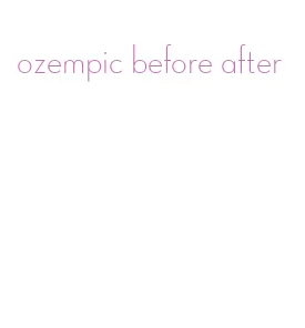 ozempic before after