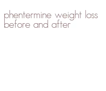 phentermine weight loss before and after
