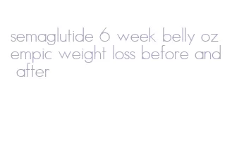 semaglutide 6 week belly ozempic weight loss before and after