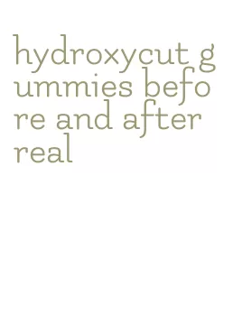 hydroxycut gummies before and after real