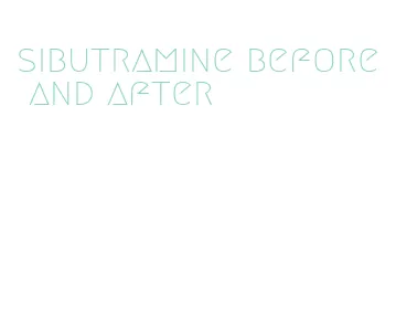 sibutramine before and after