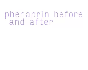 phenaprin before and after
