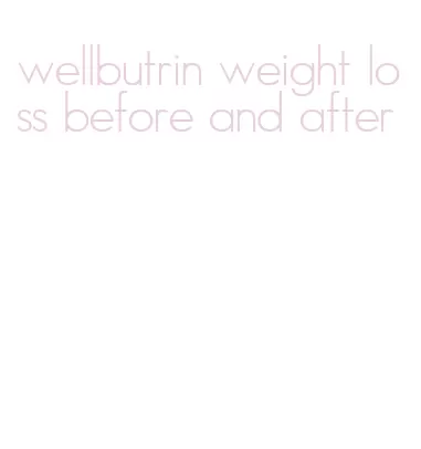 wellbutrin weight loss before and after